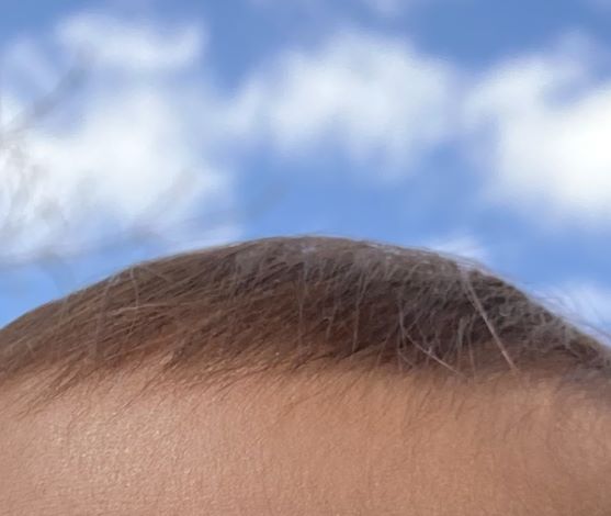 赤ちゃんの頭頂部と青空